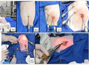 兔腹腔镜胆囊切除术不同解剖技术术后疗效比较：随机研究