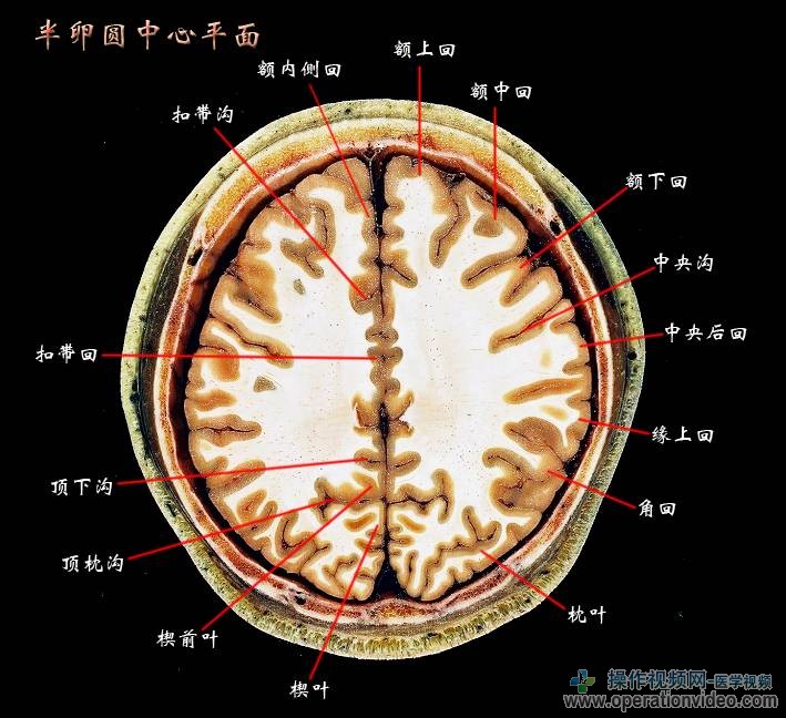 半卵圆中心平面.jpg