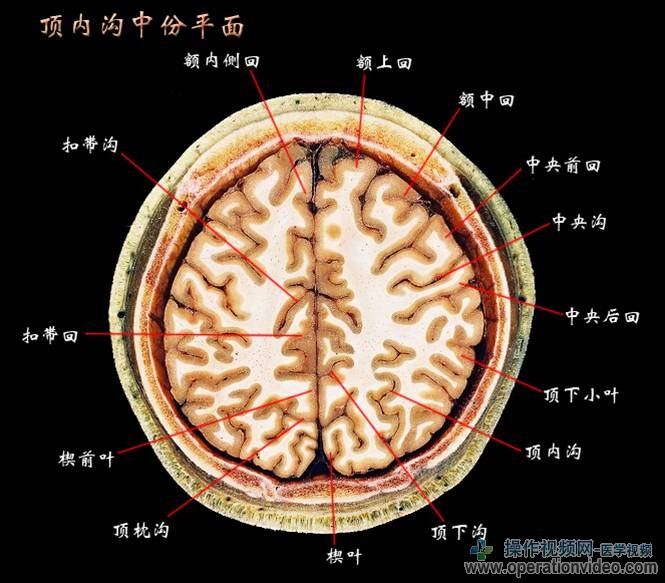 顶内沟中份平面.jpg