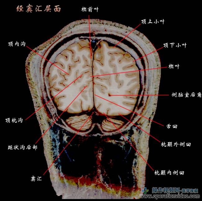 经窦汇层面].jpg