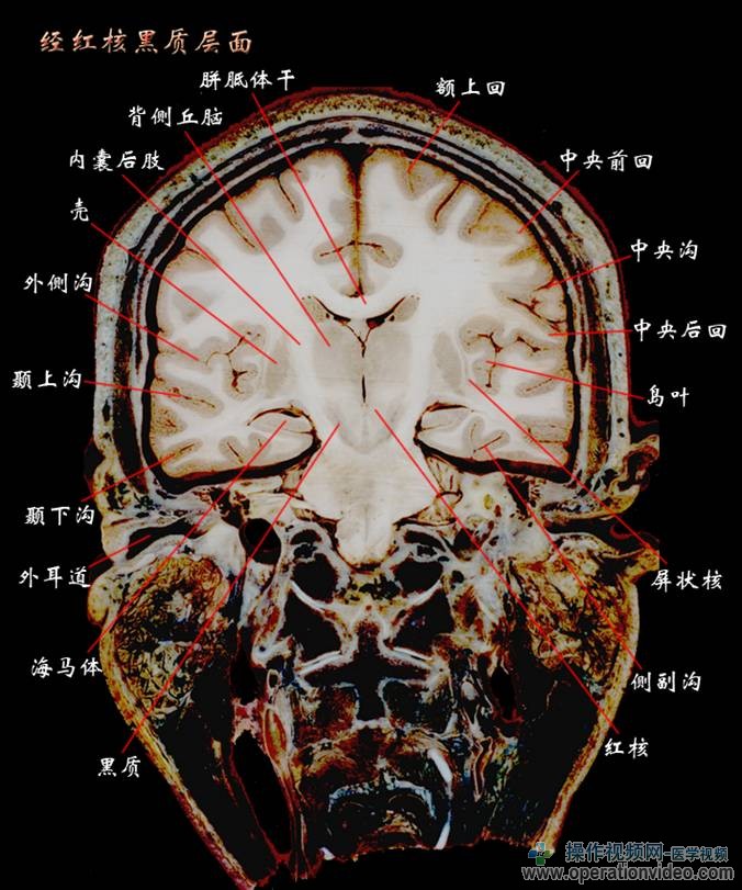 经红核黑质层面.jpg