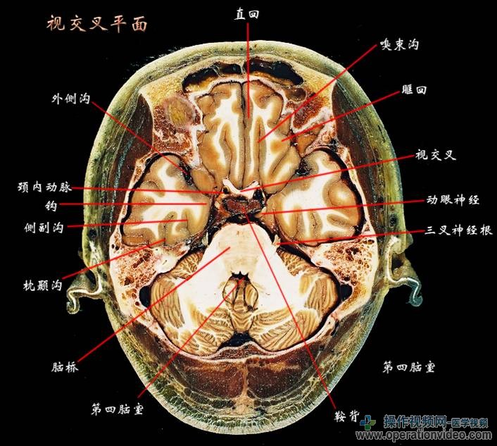 视交叉平面.jpg
