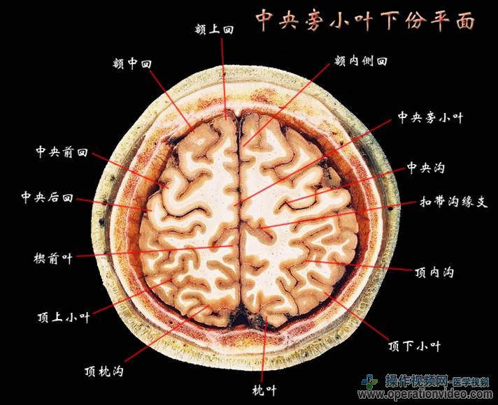 中央旁小叶下份平面.jpg