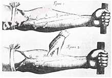 An experiment from William Harvey's de Motu Cordis, 1628