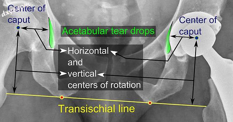 Center of rotation The horizontal center of rotation is calculated as.jpg