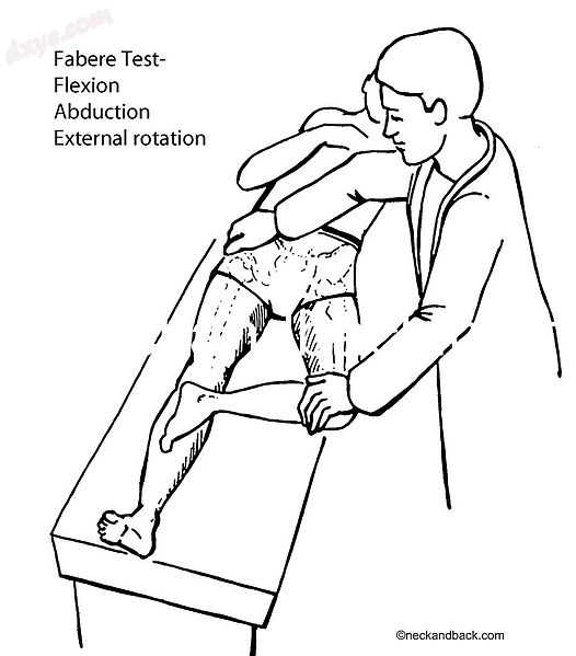 An illustration of Patrick&#039;s test.jpg