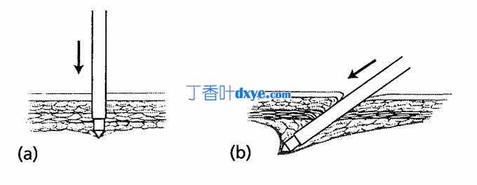 辅助套管（工作套管、附件套管）