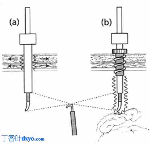 腹腔镜下组织解剖