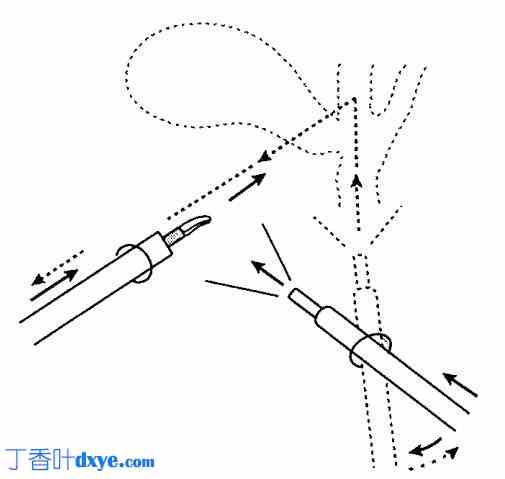 腹腔镜下组织解剖