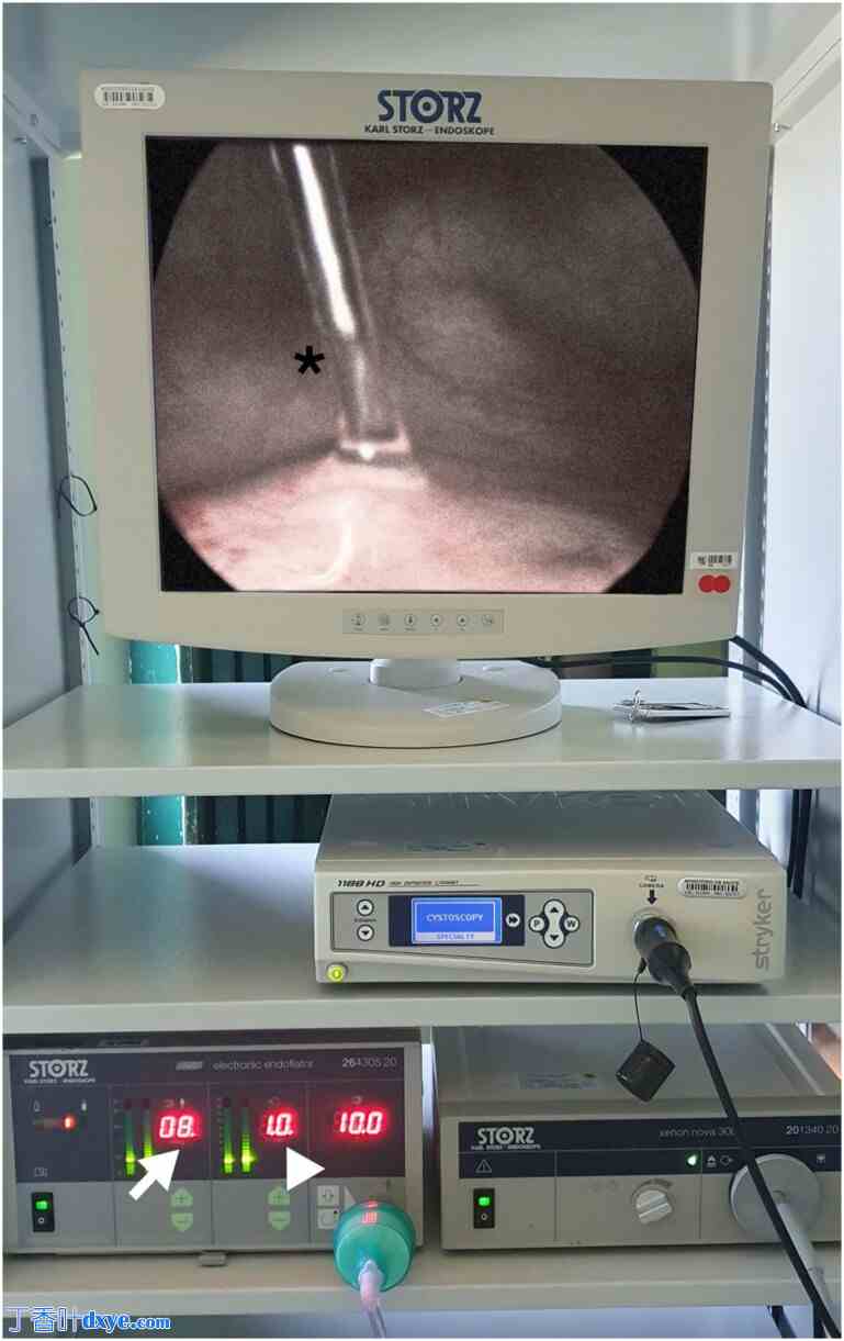 泌尿科知识和工具在深部浸润型子宫内膜异位症诊断和手术中的应用